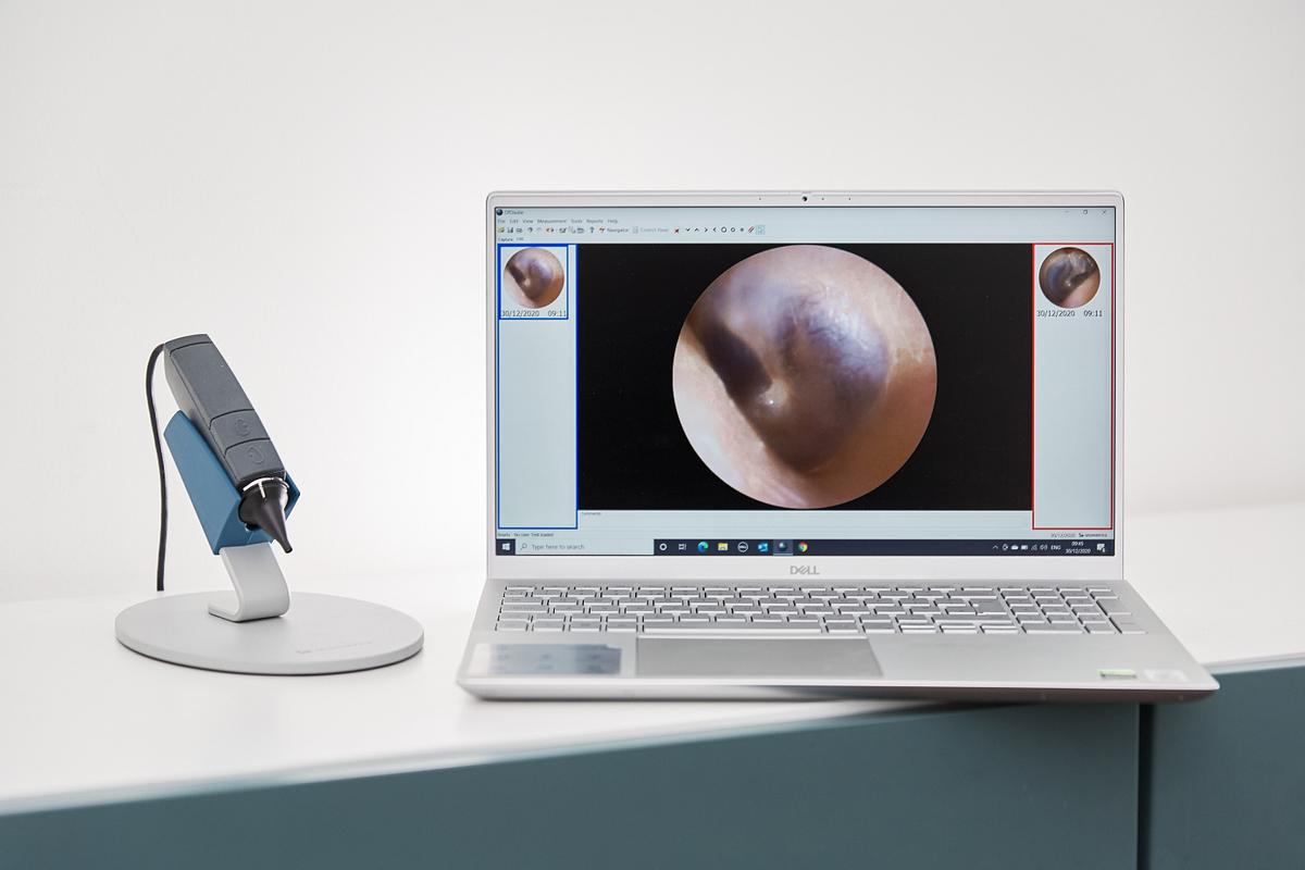 video otoscopes